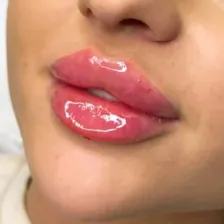 مرکز پوست و مو شمیران سنتر