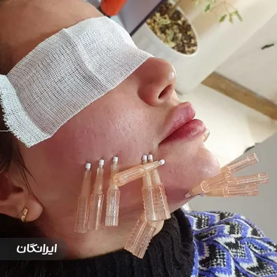 مرکز پوست و مو شمیران سنتر