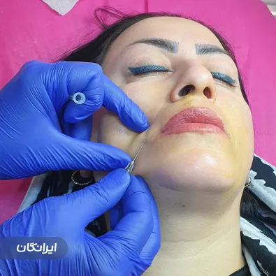 کلینیک زیبایی دکتر حسین سلطانی