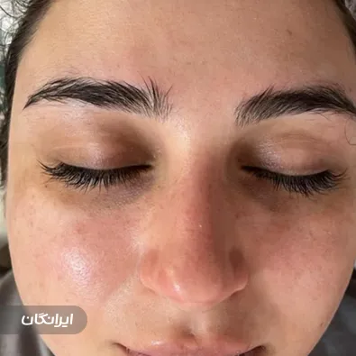 مرکز فیشیال شادی رحیمی