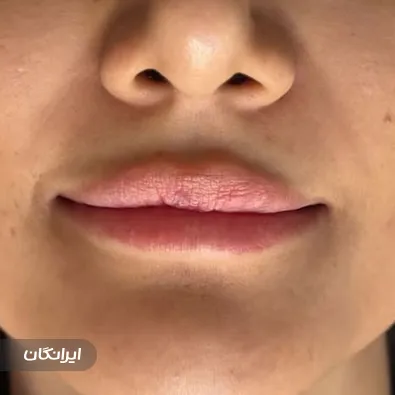 کلینیک زیبایی آس