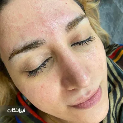 مرکز مراقبت پوستی گلناز شمایلی