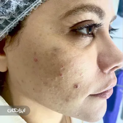 مرکز مراقبت پوستی گلناز شمایلی