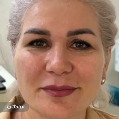 سالن زیبایی مهشید مرادی