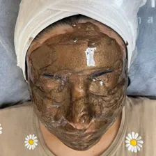 اتاق پوست وفیشیال باران