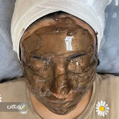 اتاق پوست وفیشیال باران