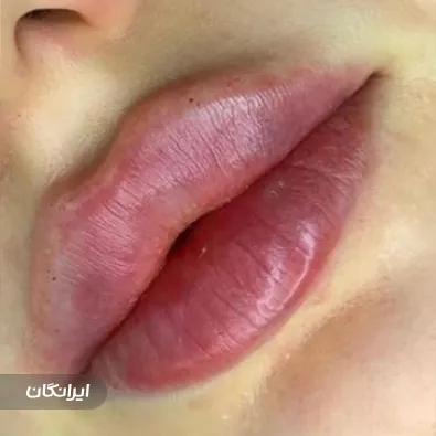 کلینیک زیبایی پرین