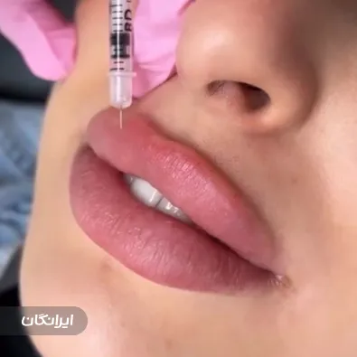 کلینیک زیبایی نیکس