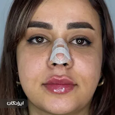 کلینیک زیبایی دیاموند