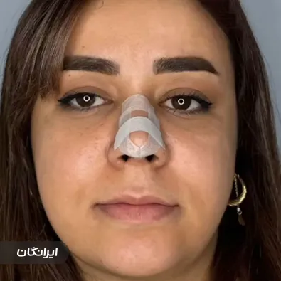 کلینیک زیبایی دیاموند