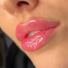 کلینیک زیبایی دیاموند