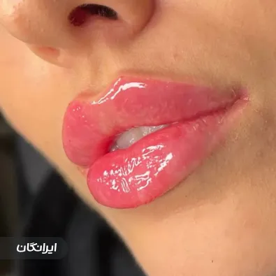 کلینیک زیبایی دیاموند