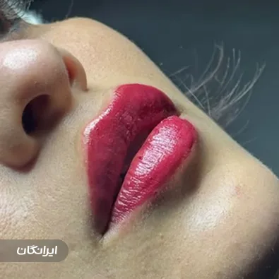 کلینیک زیبایی اکسیر