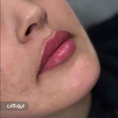 کلینیک زیبایی اکسیر