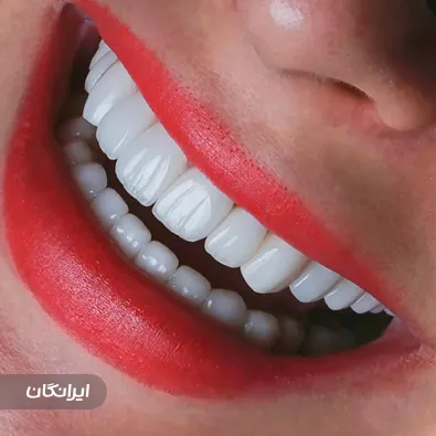 دندانپزشکی مهرانه