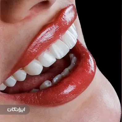 دندانپزشکی مهرانه