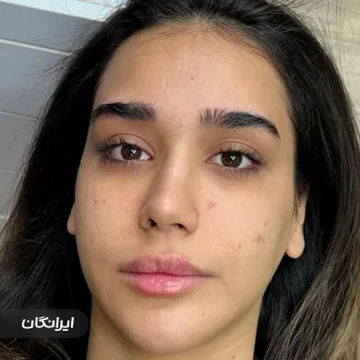 سالن زیبایی وارین