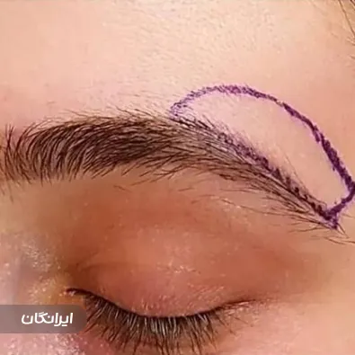 کلینیک جراحی نیو فیس