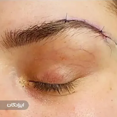 کلینیک جراحی نیو فیس