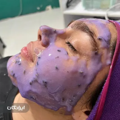 سالن فیشیال اولیون