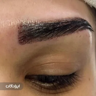 کلینیک زیبایی تارکوب