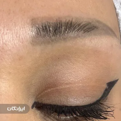 کلینیک زیبایی تارکوب