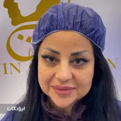 کلینیک کاشت مو نوین تهران