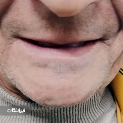 دندانسازی سانترال