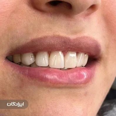 دکتر آسو حمزه ای