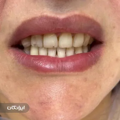 دکتر آسو حمزه ای