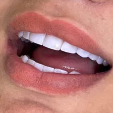 دکتر آسو حمزه ای