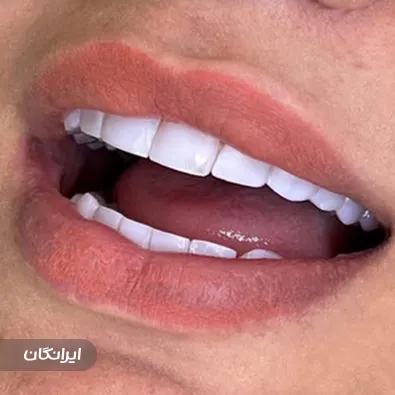 دکتر آسو حمزه ای