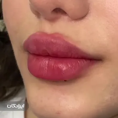 کلینیک زیبایی نیک آفرید