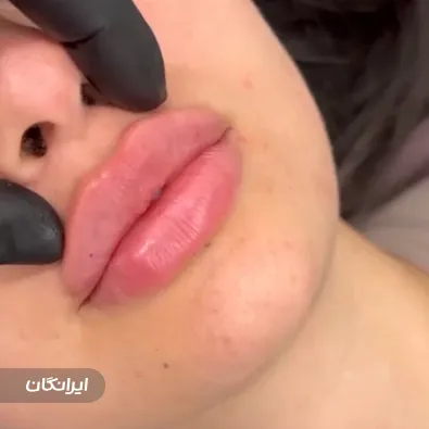 کلینیک زیبایی نیک آفرید