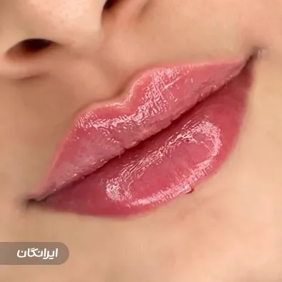 کلینیک زیبایی دکتر سمیرا همتی