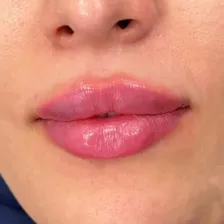 کلینیک زیبایی الما بیوتی