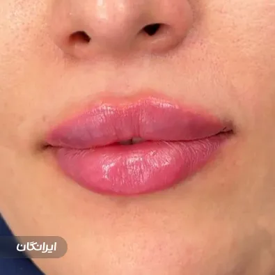 کلینیک زیبایی الما بیوتی