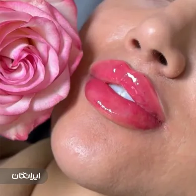 کلینیک زیبایی مینا خرم نسب