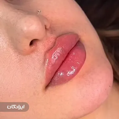 کلینیک زیبایی راما