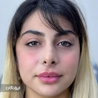 کلینیک زیبایی دکتر فرهاد حسینی