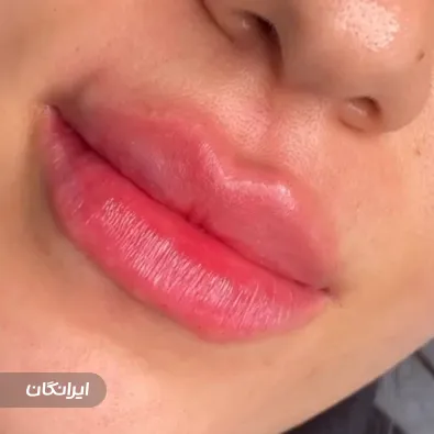 کلینیک زیبایی پاییزان