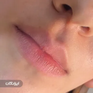 کلینیک زیبایی پاییزان