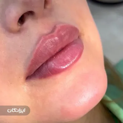 کلینیک زیبایی ویتا