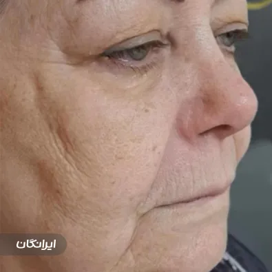 کلینیک زیبایی ماه نقره ای