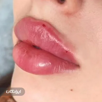 کلینیک زیبایی ماه نقره ای