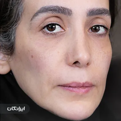 کلینیک زیبایی دکتر زهرا شیخ حسنی