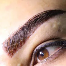 کلینیک کاشت مو زندیه