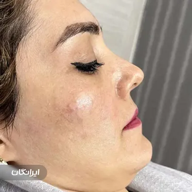 کلینیک زیبایی ساینا