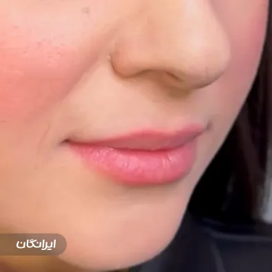 کلینیک زیبایی لوتس