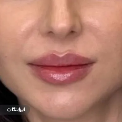 کلینیک زیبایی دکتر زهرا اصفهانی آتش بیگ